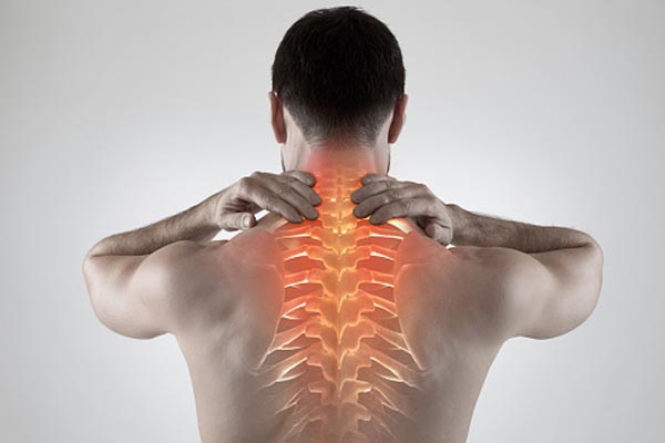 Cervical Spondylitis