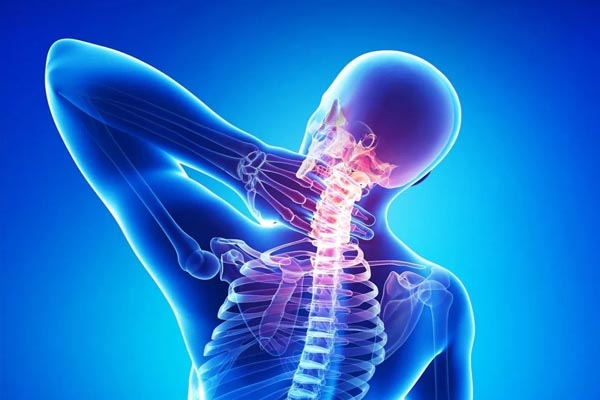 Osteoarthritis Of Spine